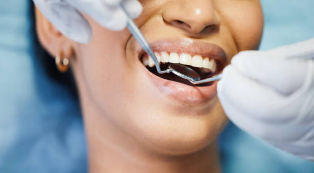 Best Emergency Wisdom Teeth Removal in Eming Island, FL